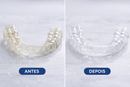 WhiteAlign Espuma