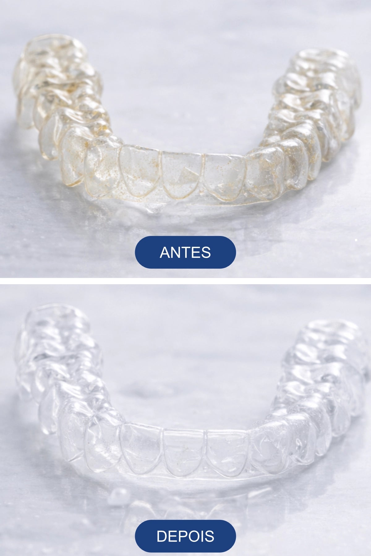 Antes e Depois de alinhador usar Espuma Clareadora
