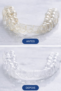 Antes e Depois de alinhador usar Espuma Clareadora